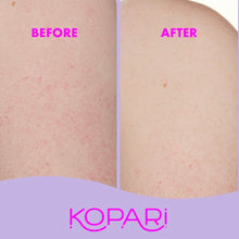 Load image into Gallery viewer, KP Bumps Be Gone Soothing Lotion With 10% AHA