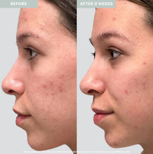 Load image into Gallery viewer, Glo Microbiome Restoring PM Moisturizer