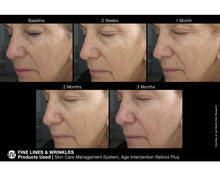 Load image into Gallery viewer, Jan Marini Age Intervention Retinol Plus