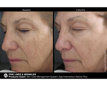 Load image into Gallery viewer, Jan Marini Age Intervention Retinol Plus
