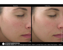Load image into Gallery viewer, Jan Marini Luminate Face Lotion
