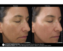 Load image into Gallery viewer, Jan Marini Luminate Face Lotion
